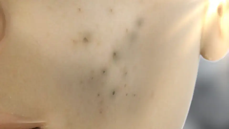 [색소침착/미백] 마일드랩 딥 멜라케어 스팟 트리트먼트 오인트겔 20ml 상세페이지 12